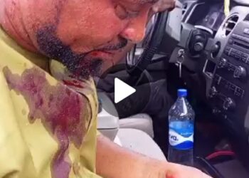 AGAIN KOGI GOVERNOR’S THUGS OPEN FIRE ON AJAKA’S CAMPAIGN TRAIN.  ….. Several SDP Supporters wounded. 