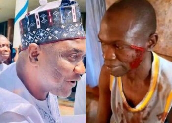 Again APC Thugs “Echocho Boys” Continues Their Onslaught on SDP Supporters in Kogi East.