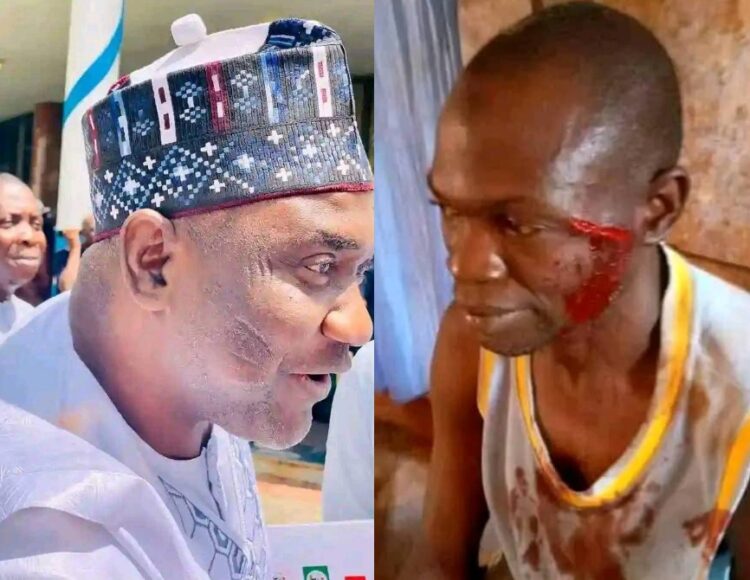 Again APC Thugs “Echocho Boys” Continues Their Onslaught on SDP Supporters in Kogi East.